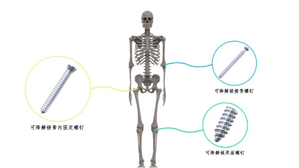 喜讯：4688美高梅登录中心科技荣获2024中华医学科技奖